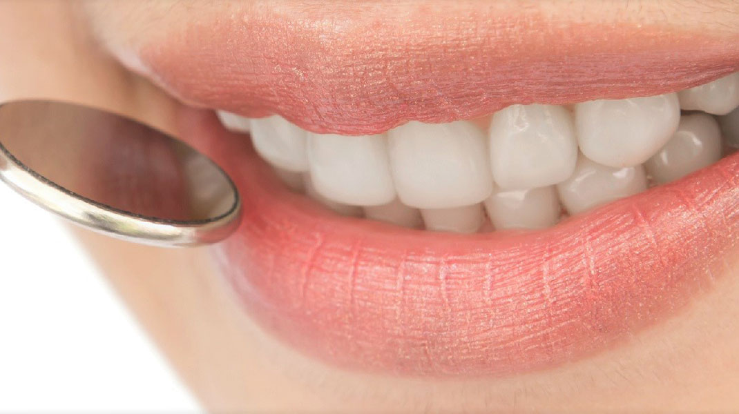 کاشت دندان بدون ایمپلنت با تکنولوژی جدید