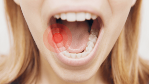 درد بعد از عصب کشی دندان